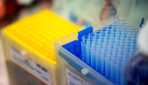 Test tubes in lab setting